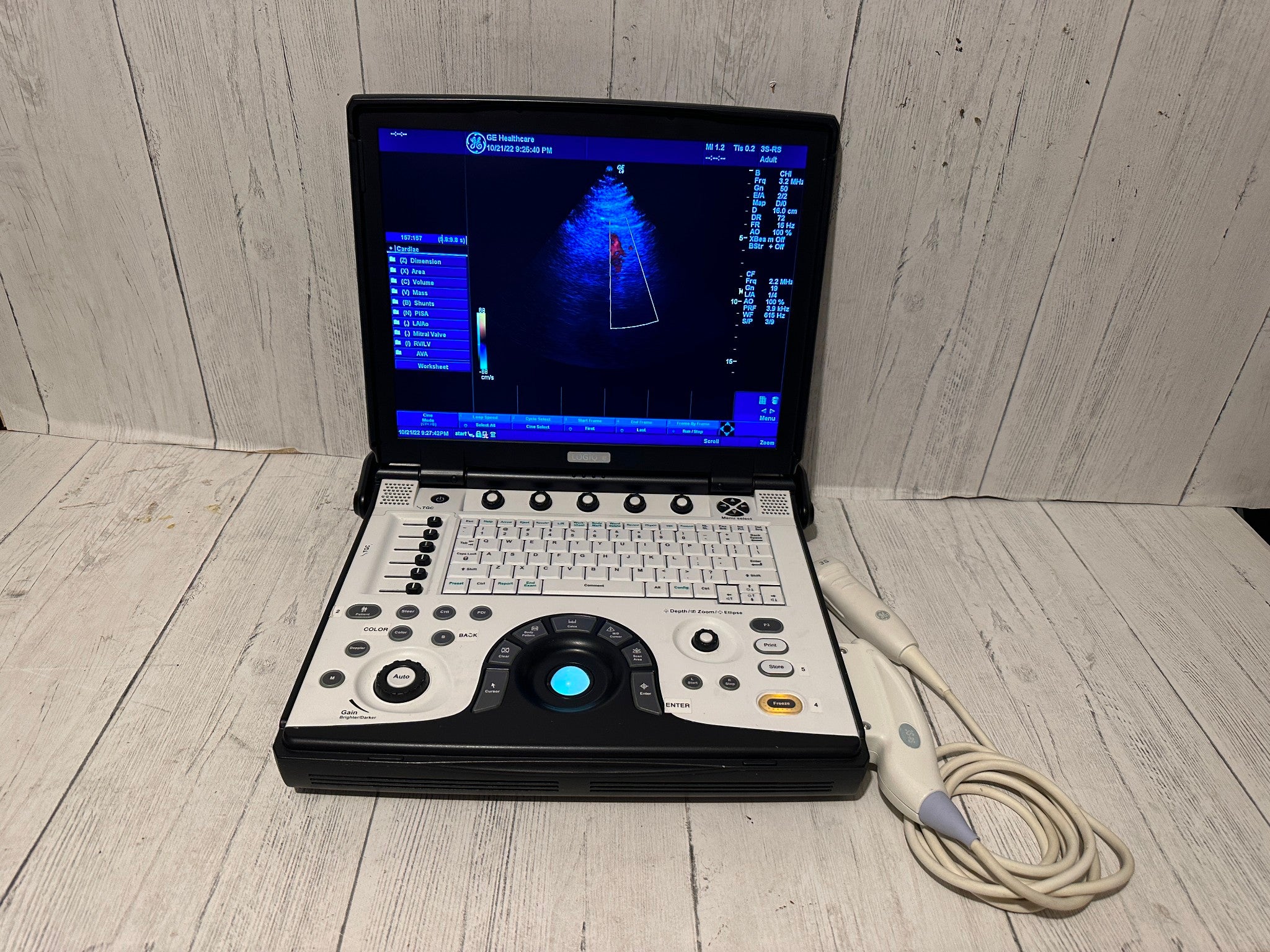 GE LOGIQ E Next Generation Ultrasound BT12 with 3S-RS Probe 2012