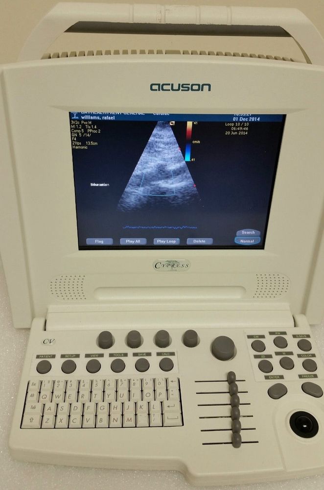 2010 SIEMENS~ACUSON CYPRESS -14 ULTRASOUND + Cardiac Probe +DOPPLER. WORKS FINE DIAGNOSTIC ULTRASOUND MACHINES FOR SALE