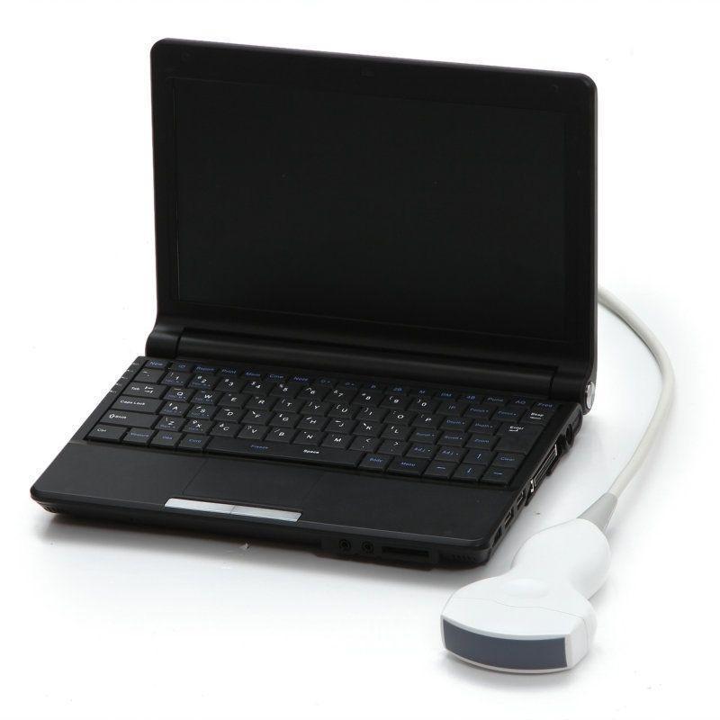 HOT Laptop Digital Ultrasound Scanner Machine Transvaginal + Convex 2 Probe + 3D DIAGNOSTIC ULTRASOUND MACHINES FOR SALE