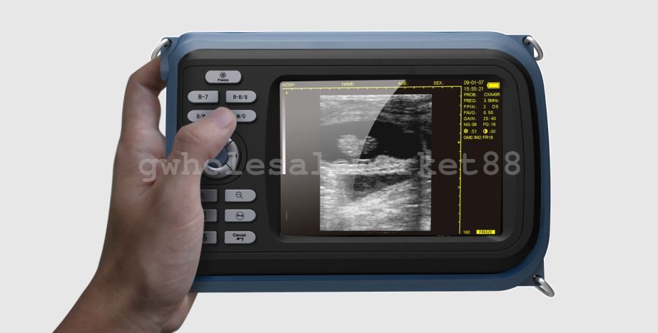 Veterinary Medical VET Digital Ultrasound Scanner Animal Rectal Probe + Oximeter 190891057464 DIAGNOSTIC ULTRASOUND MACHINES FOR SALE