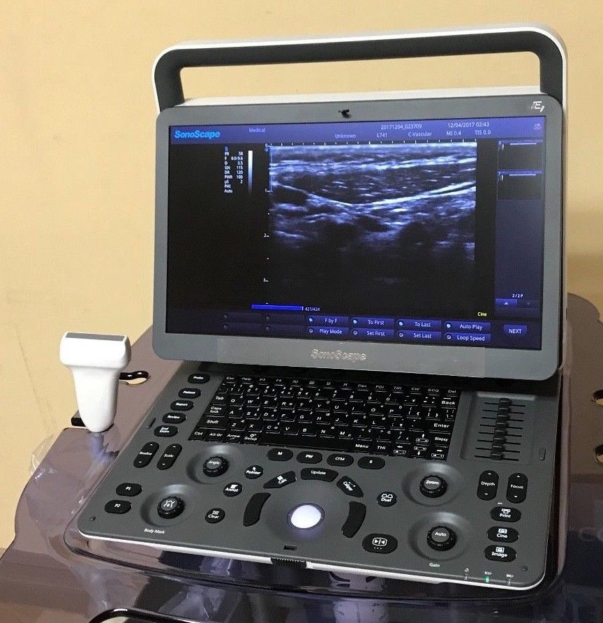 Sonoscap E1 Portable Ultrasound machine with Linear array probe DIAGNOSTIC ULTRASOUND MACHINES FOR SALE