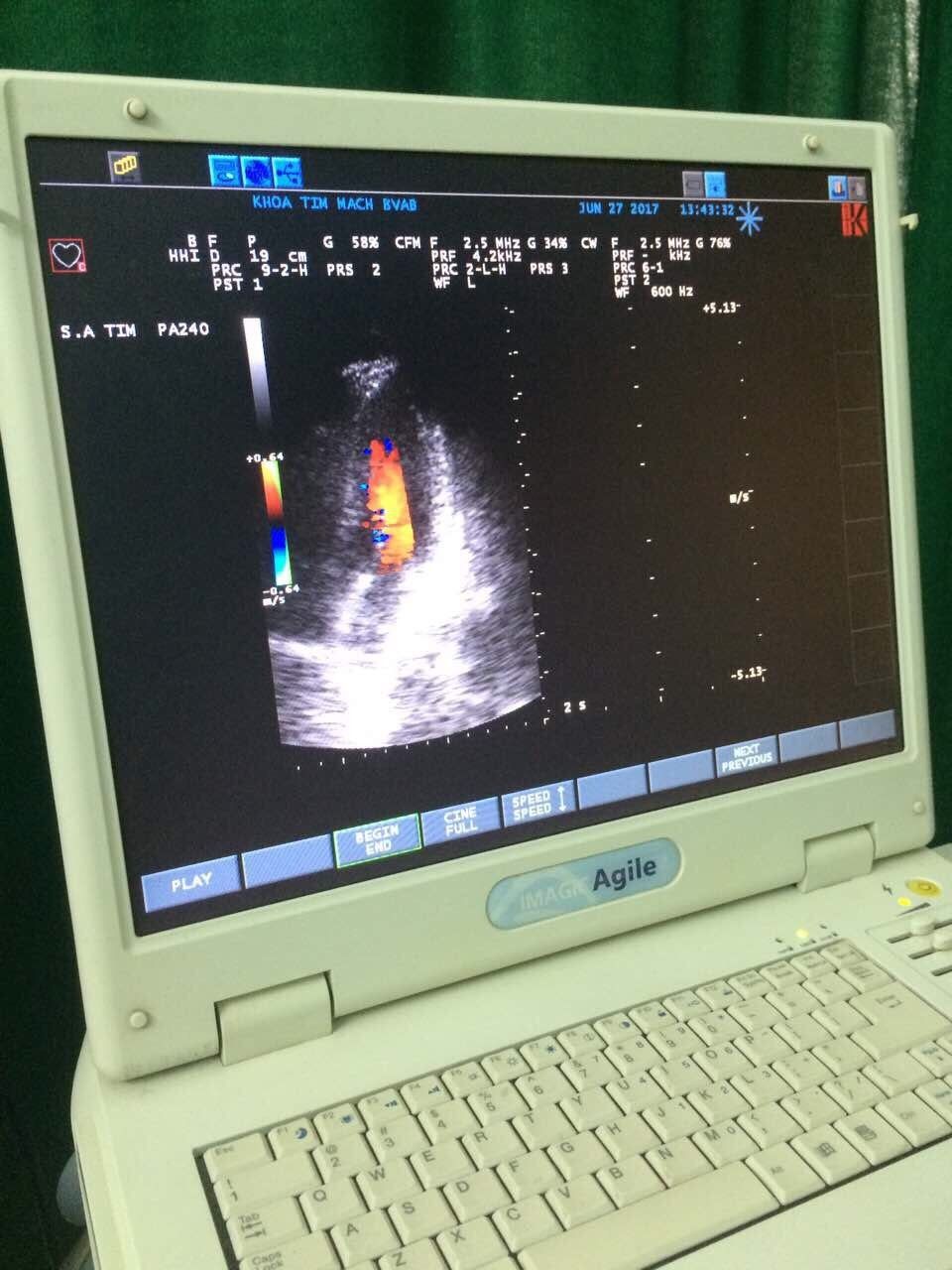 Esaote Biosound Megas/ MyLab ultrasound PA240 Phase Array probe DIAGNOSTIC ULTRASOUND MACHINES FOR SALE
