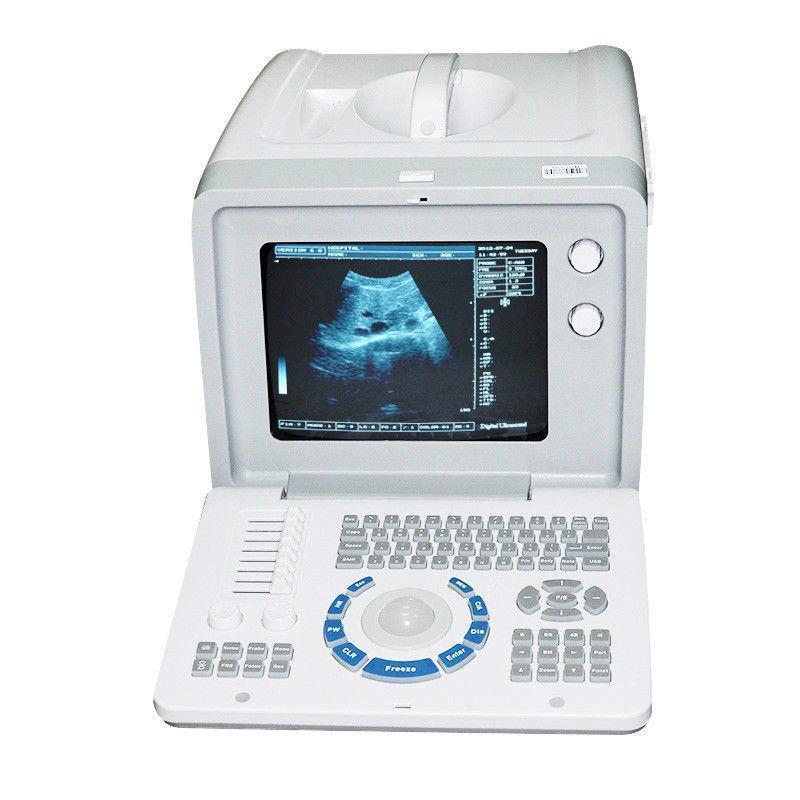 Portable digital Ultrasound Scanner Machine 3.5 convex &7.5 Transvaginal Probe DIAGNOSTIC ULTRASOUND MACHINES FOR SALE