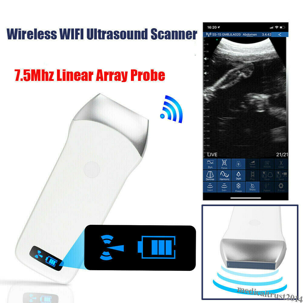Portable Human Handheld WIFI Wireless Ultrasound Scanner Machine Linear Probe DIAGNOSTIC ULTRASOUND MACHINES FOR SALE