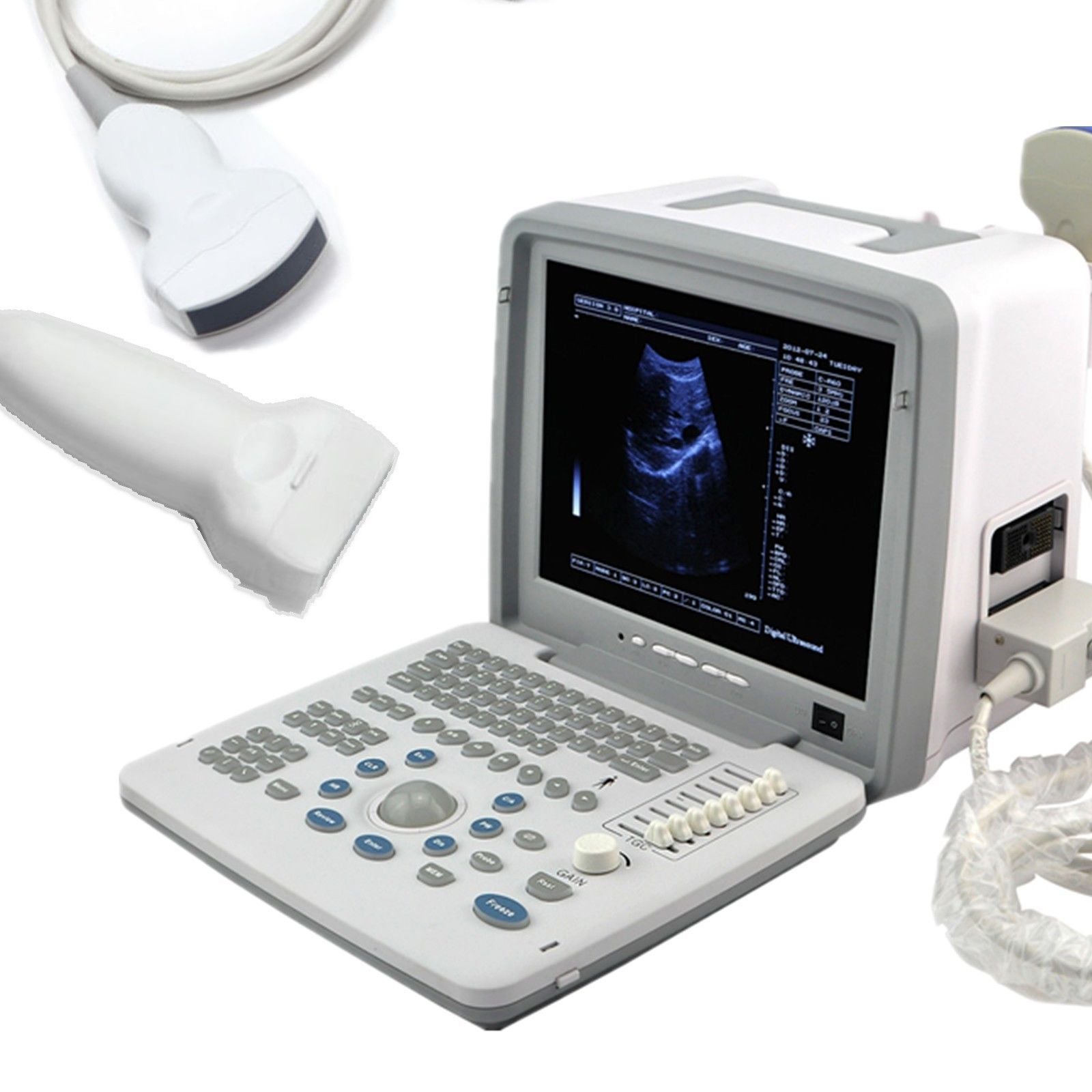 Portable Digital Ultrasound Machine Scanner System+ Convex + Linear Probe +3D CE 190891052384 DIAGNOSTIC ULTRASOUND MACHINES FOR SALE