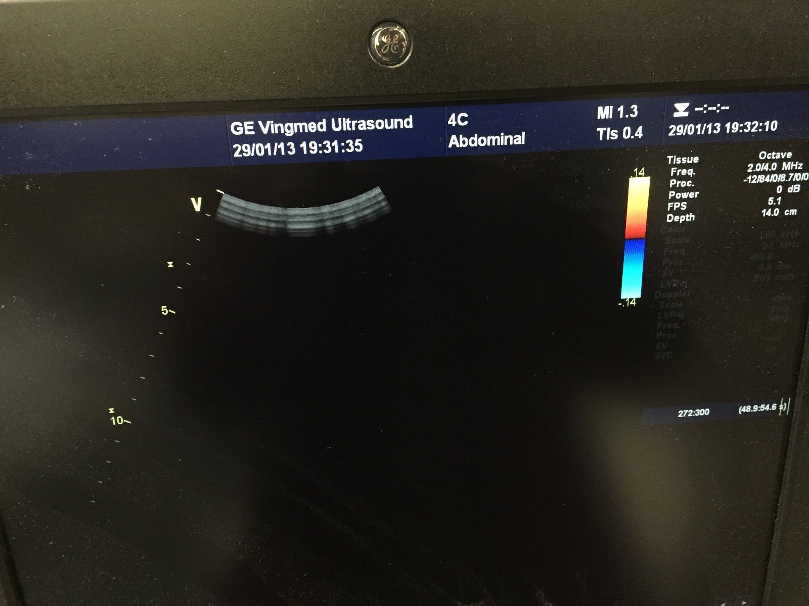 GE 4CD Ultrasound Transducer Probe DIAGNOSTIC ULTRASOUND MACHINES FOR SALE