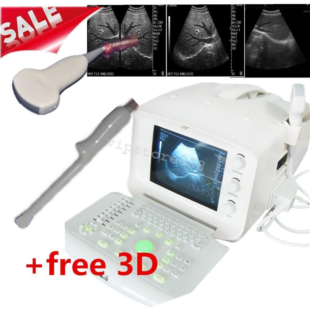 Convex Probe &Transvaginal Probe Digital Portable Ultrasound Scanner