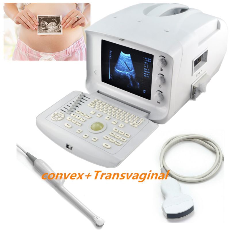 LCD 3D Image Digital Ultrasound Scanner Monitor Convex Transvaginal Probes USB DIAGNOSTIC ULTRASOUND MACHINES FOR SALE