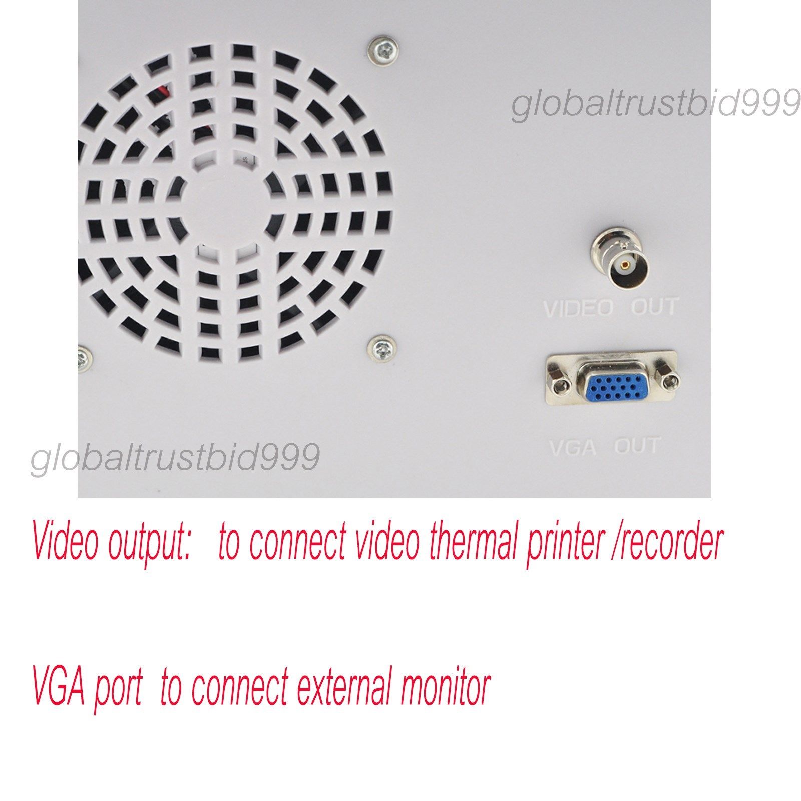 Portable 10.1 Inch Ultrasound Scanner Test Convex Transvaginal Probes USB SVGA DIAGNOSTIC ULTRASOUND MACHINES FOR SALE