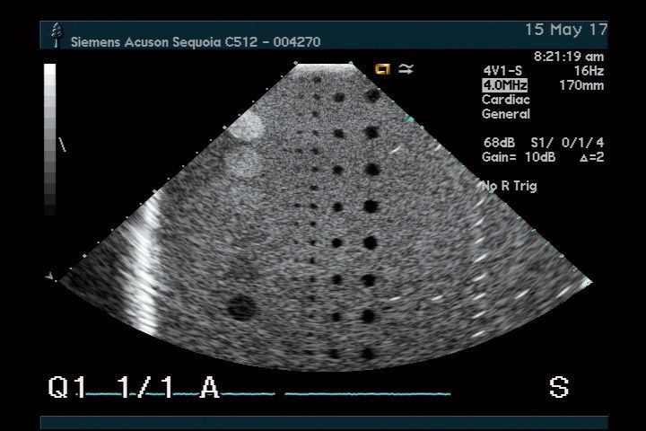 Acuson 4V1 for Sequoia Ultrasound Transducer DIAGNOSTIC ULTRASOUND MACHINES FOR SALE
