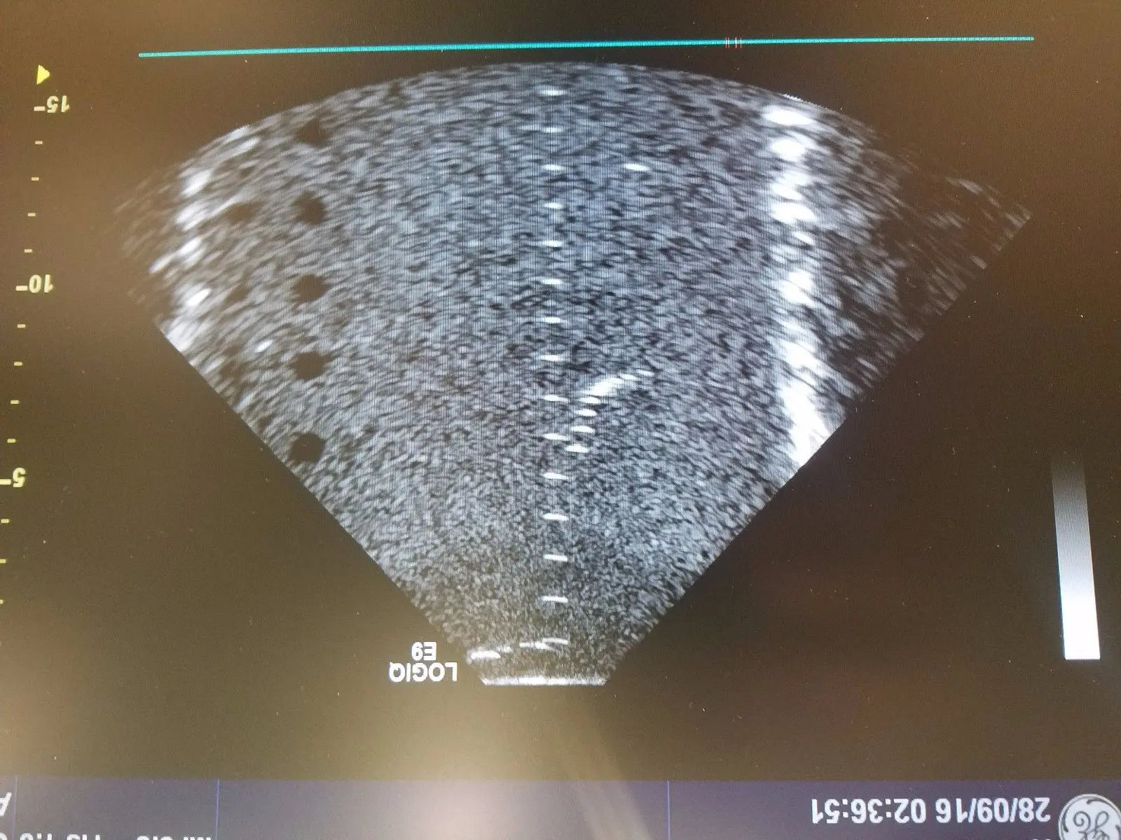 GE S1-5 Ultrasound Transducer Probe DIAGNOSTIC ULTRASOUND MACHINES FOR SALE