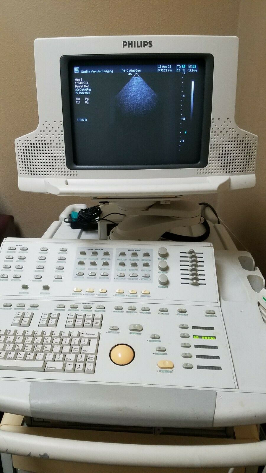 Phillips HDI 5000 Ultrasound Instrument DIAGNOSTIC ULTRASOUND MACHINES FOR SALE