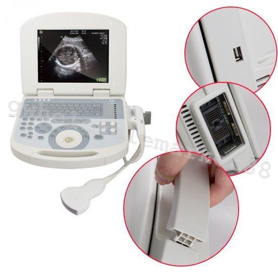USA High Resolution Laptop Medical Ultrasound Scanner Convex probe +3D Software 190891422491 DIAGNOSTIC ULTRASOUND MACHINES FOR SALE