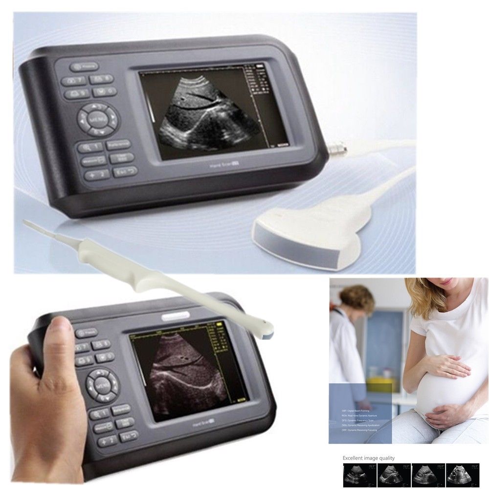 Clinic Human Ultrasound Scanner Machine System Convex Probe Abdominal + Oximeter 190891827272 DIAGNOSTIC ULTRASOUND MACHINES FOR SALE