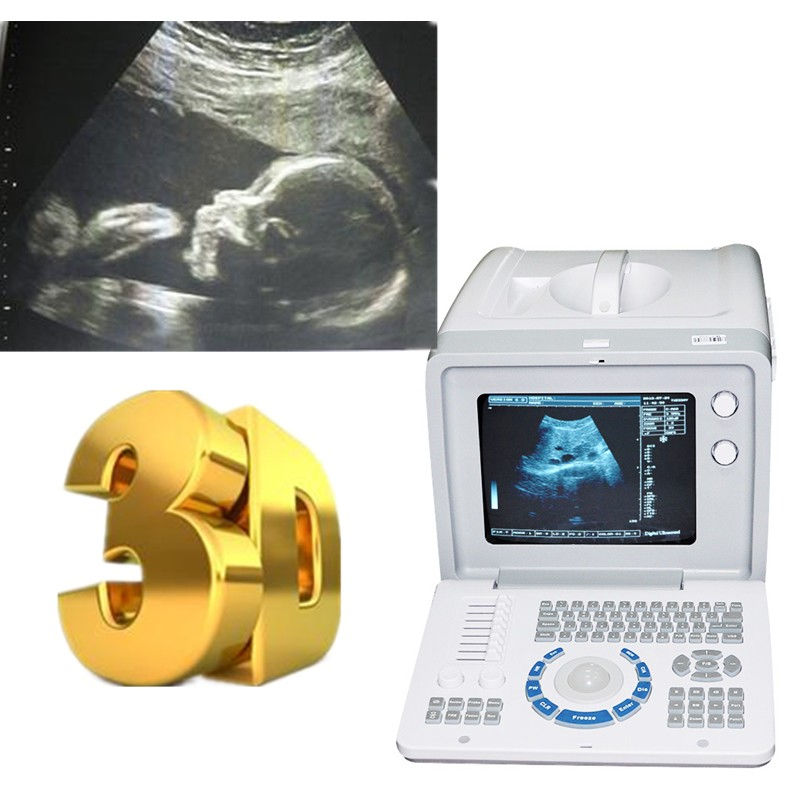 Medical Ultrasonic Ultrasound Machine Covex +Linear+Transvaginal 3 Probes 3D AA DIAGNOSTIC ULTRASOUND MACHINES FOR SALE