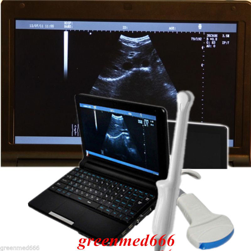 HOT Laptop Digital Ultrasound Scanner Machine Transvaginal + Convex 2 Probe + 3D DIAGNOSTIC ULTRASOUND MACHINES FOR SALE