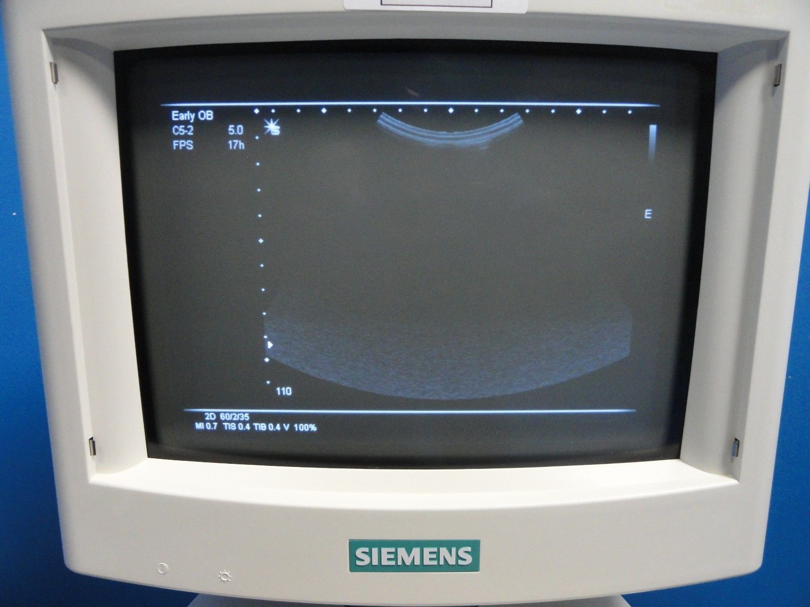 2004 Siemens C5-2 CONVEX ARRAY Ultrasound Probe for Sonoline G20 (11477) DIAGNOSTIC ULTRASOUND MACHINES FOR SALE