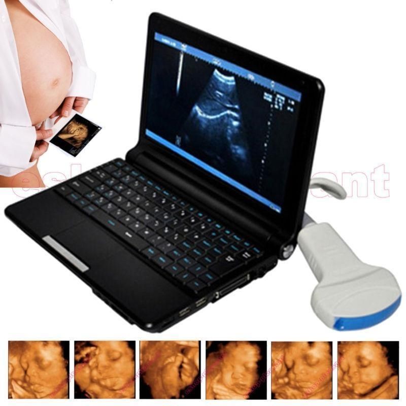 Laptop Portable Ultrasound Scanner Machine 3.5Mhz Convex  probe/Sensor 3D& Gift 190891916501 DIAGNOSTIC ULTRASOUND MACHINES FOR SALE
