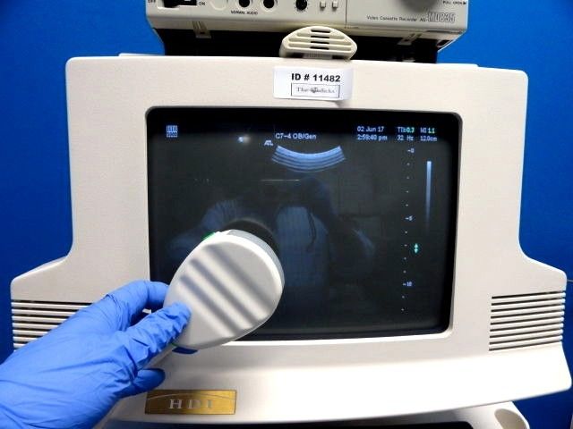 a hand in a blue glove holding probe in front of monitor