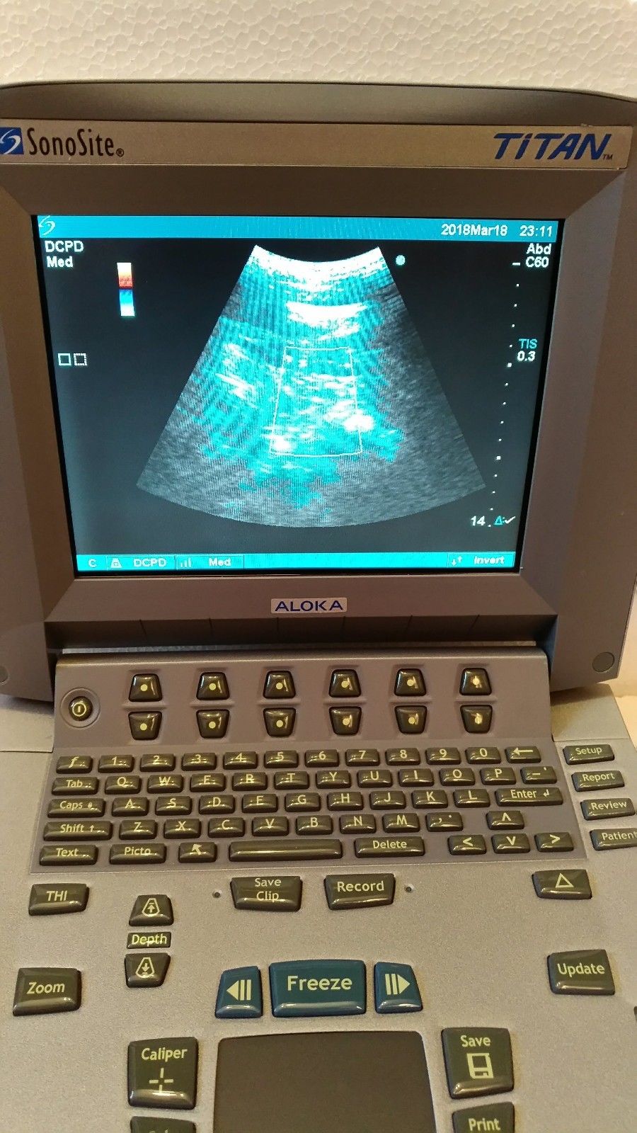 Sonosite Titan portable ultrasound system MODULE ONLY DIAGNOSTIC ULTRASOUND MACHINES FOR SALE
