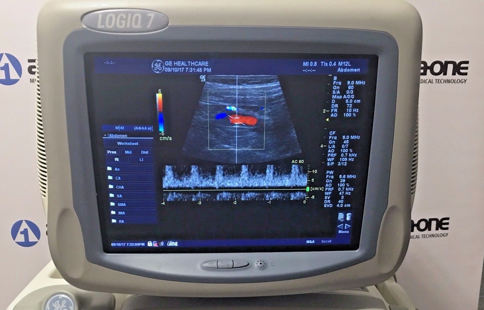 GE Logiq 9 Ultrasound System with 3.5C, E8C, 7L, 10L, and M12L  Transducers DIAGNOSTIC ULTRASOUND MACHINES FOR SALE