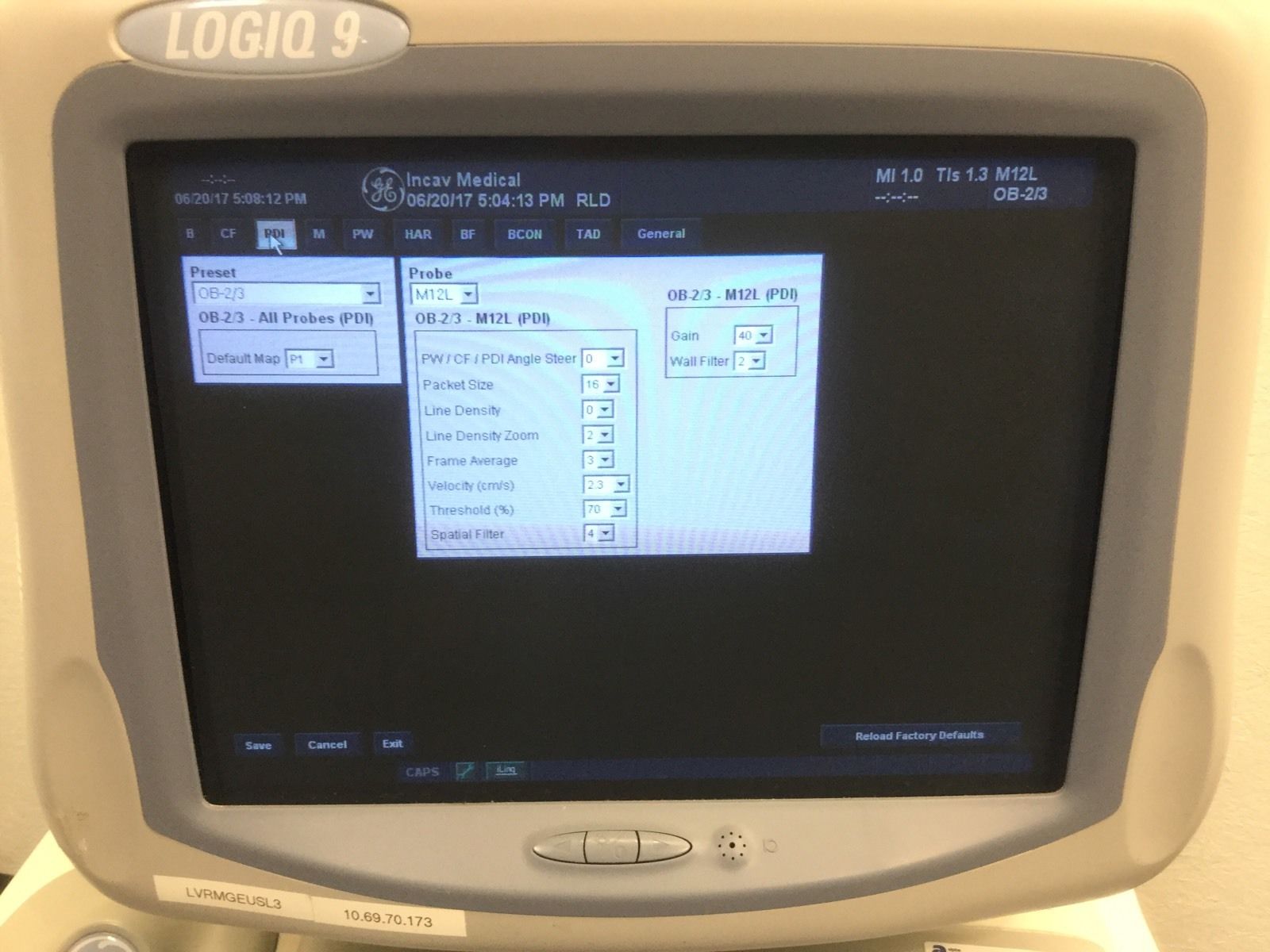 GE Logiq 9 Ultrasound  2003  BT03 + 8L + M12L + 3.5C DIAGNOSTIC ULTRASOUND MACHINES FOR SALE