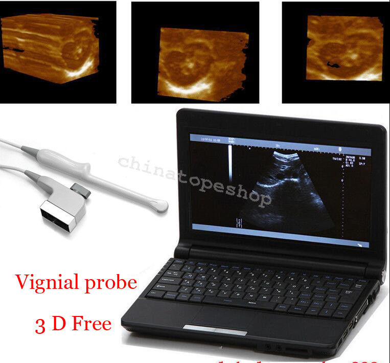Laptop Machine Ultrasound scanner  Transvaginal probe 3D Worksation + Case 190891297143 DIAGNOSTIC ULTRASOUND MACHINES FOR SALE