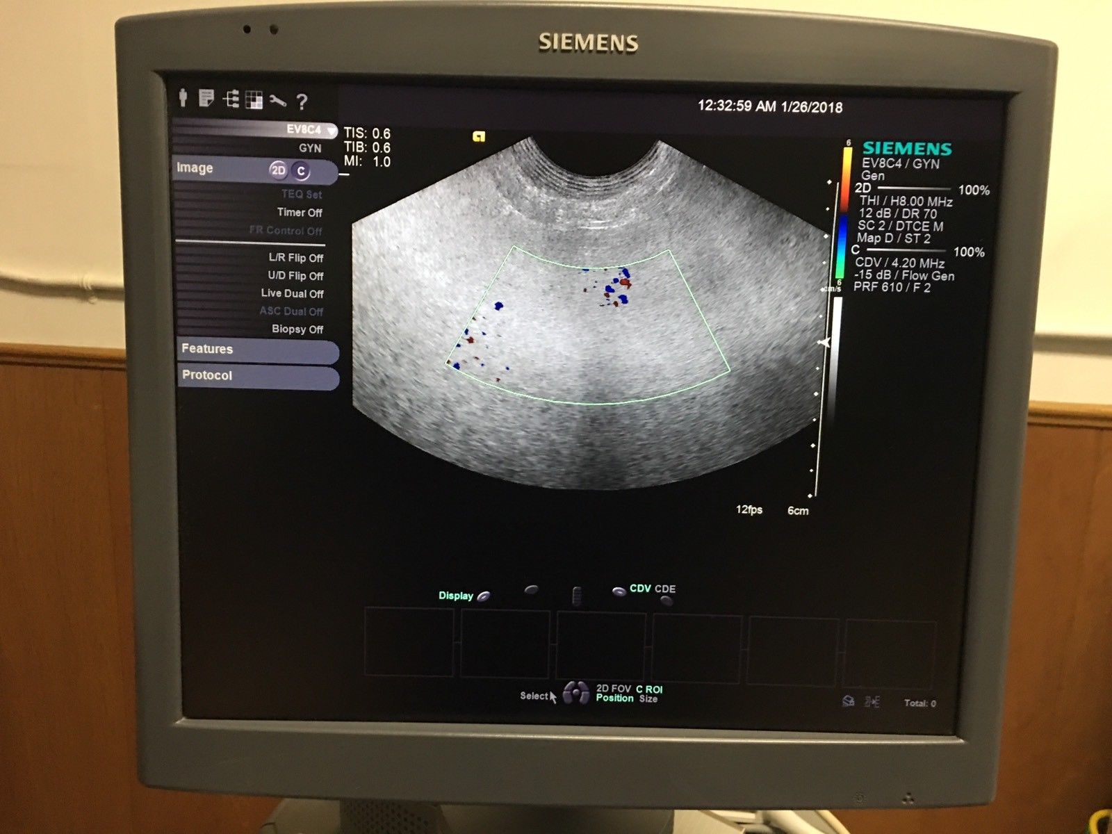 Ultrasound probe SIEMENS ACUSON EV-8C4 DIAGNOSTIC ULTRASOUND MACHINES FOR SALE