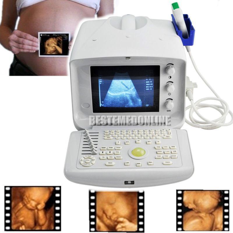 Portable Ultrasound ultrasonic Scanner Machine convex +Transvaginal Probes JXKH! DIAGNOSTIC ULTRASOUND MACHINES FOR SALE