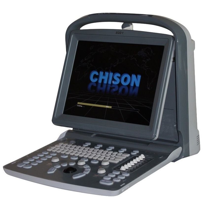 Chison ECO1 Portable LED Ultrasound Scanner with Printer, Quality and Affordable DIAGNOSTIC ULTRASOUND MACHINES FOR SALE
