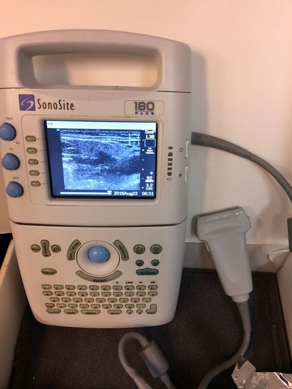 Sonosite 180 Plus portable ultrasound, 2006, 180+ DIAGNOSTIC ULTRASOUND MACHINES FOR SALE