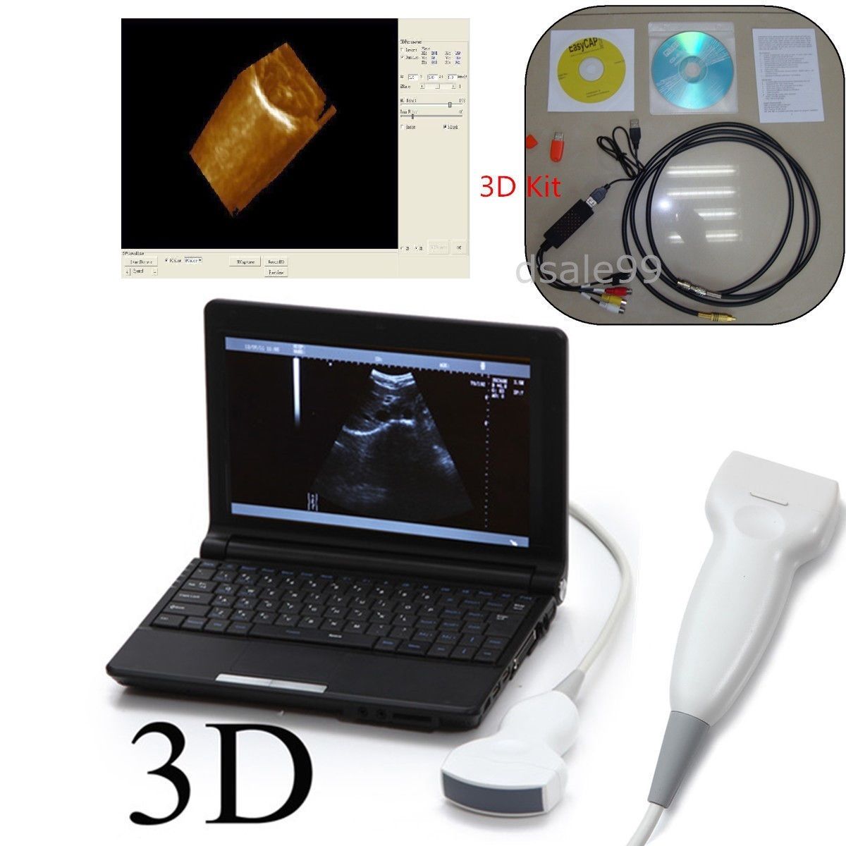 10.1'' Digital Portable Ultrasound Scanner/Machine Convex+Linear 2 Probes Sale DIAGNOSTIC ULTRASOUND MACHINES FOR SALE