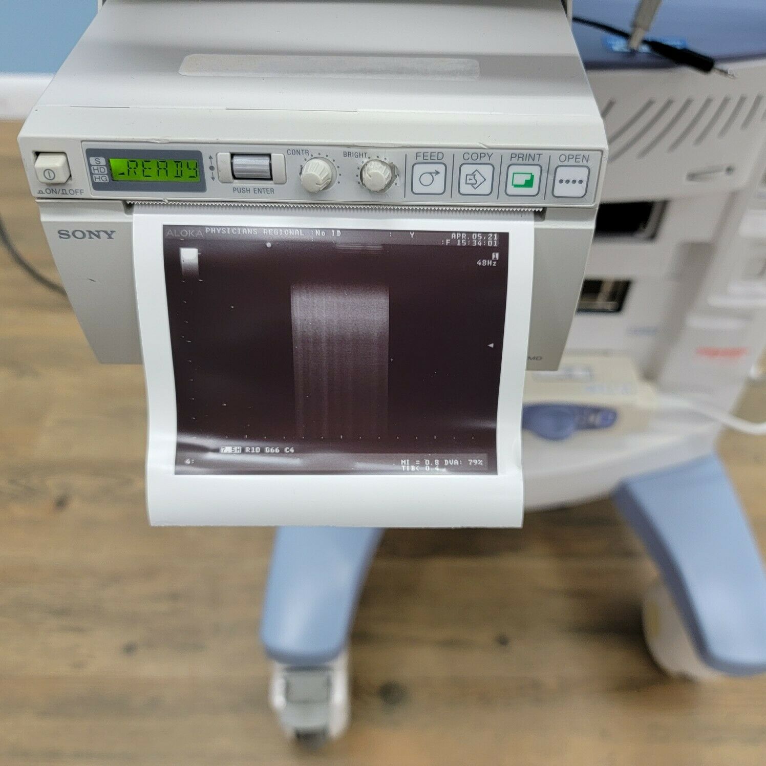 Aloka SSD-3500SX Prosound Ultrasound System DIAGNOSTIC ULTRASOUND MACHINES FOR SALE
