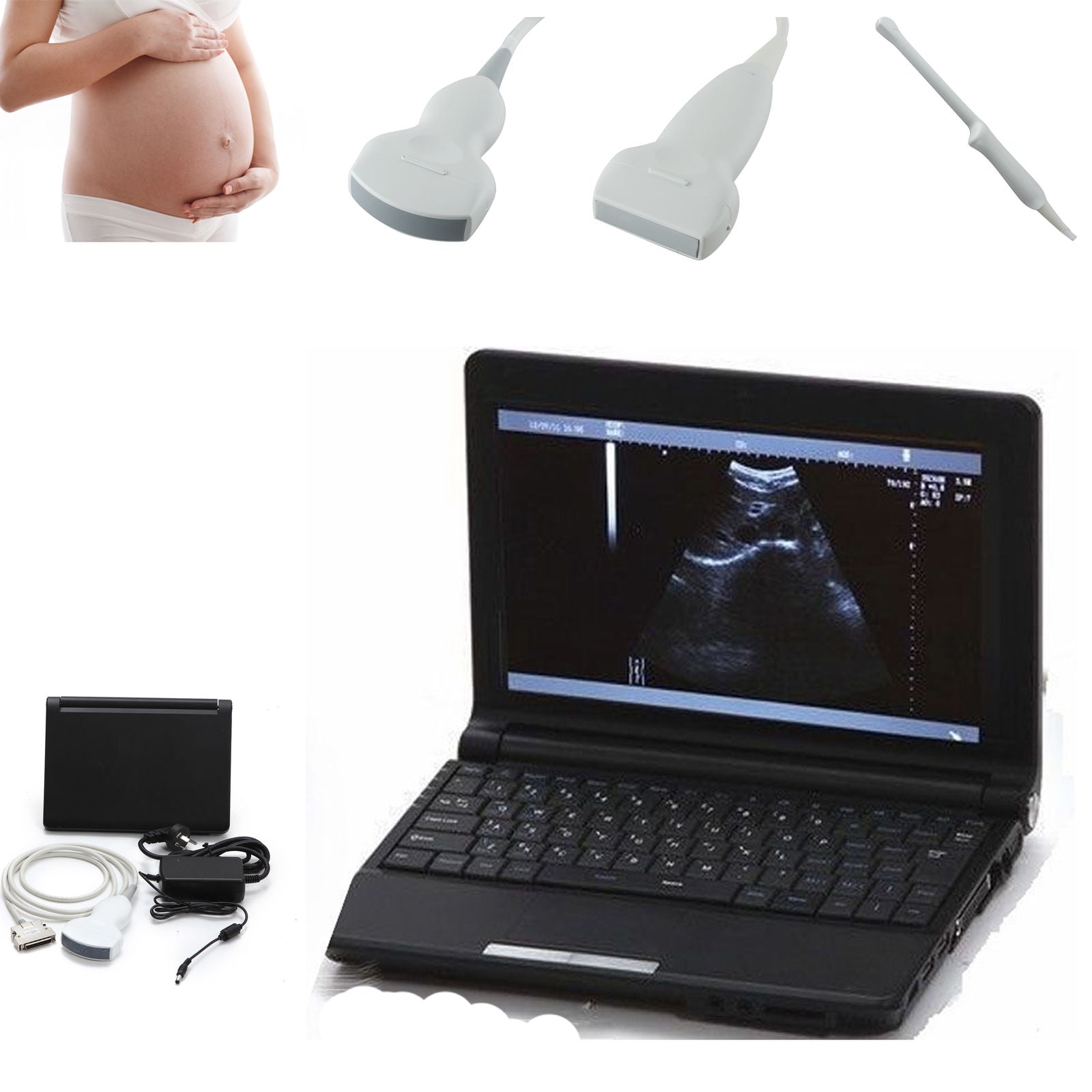 Digital Laptop Notebook Ultrasound Scanner+Convex+Linear+TranVagin Probe 10" LCD DIAGNOSTIC ULTRASOUND MACHINES FOR SALE