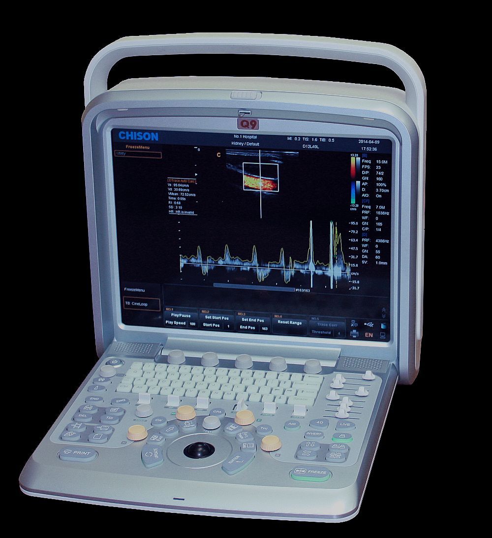 Advanced Cardiac Ultrasound Chison Q9 Color Doppler with Phased Array Probe DIAGNOSTIC ULTRASOUND MACHINES FOR SALE