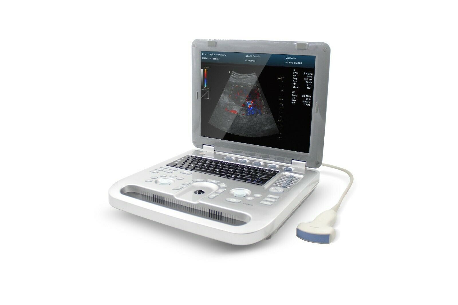 Portable Ultrasound Scanner Color Doppler Muscle Blood Vessel CW Optional 3D/ 4D DIAGNOSTIC ULTRASOUND MACHINES FOR SALE