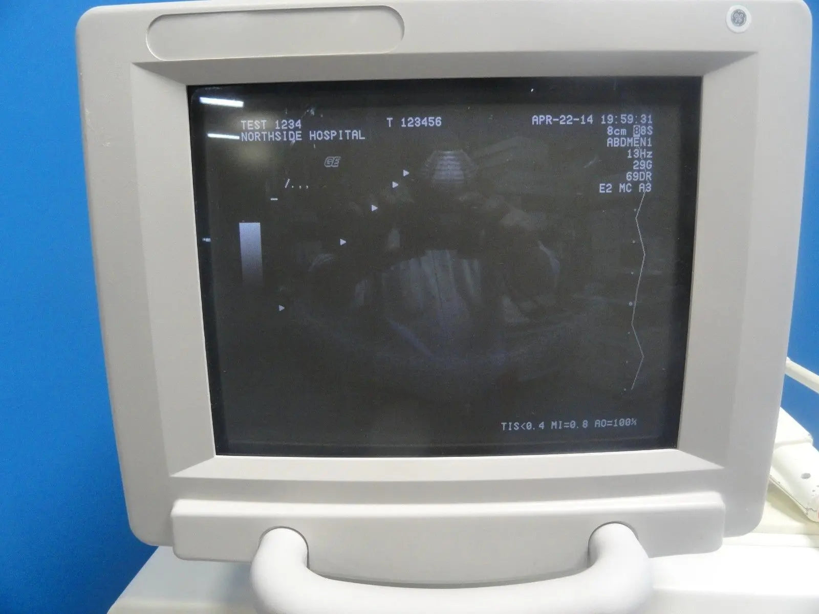 2001 GE 8S P/N 2266327 Cardiac Sector Ultrasound Transducer W/ Hook (6693) DIAGNOSTIC ULTRASOUND MACHINES FOR SALE