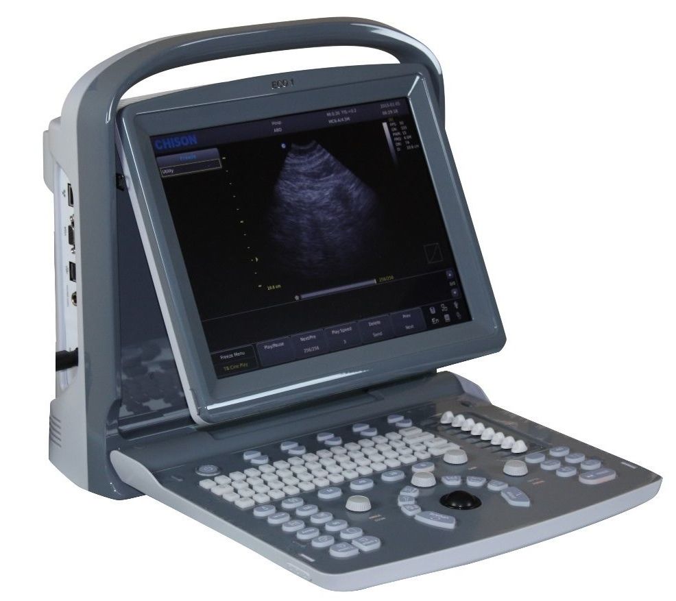 Chison ECO1 Portable LED Ultrasound Scanner with Printer, Quality and Affordable DIAGNOSTIC ULTRASOUND MACHINES FOR SALE