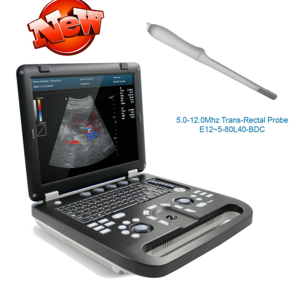 New Color Doppler Ultrasound Scanner Portable Laptop Machine with Rectal Probe DIAGNOSTIC ULTRASOUND MACHINES FOR SALE