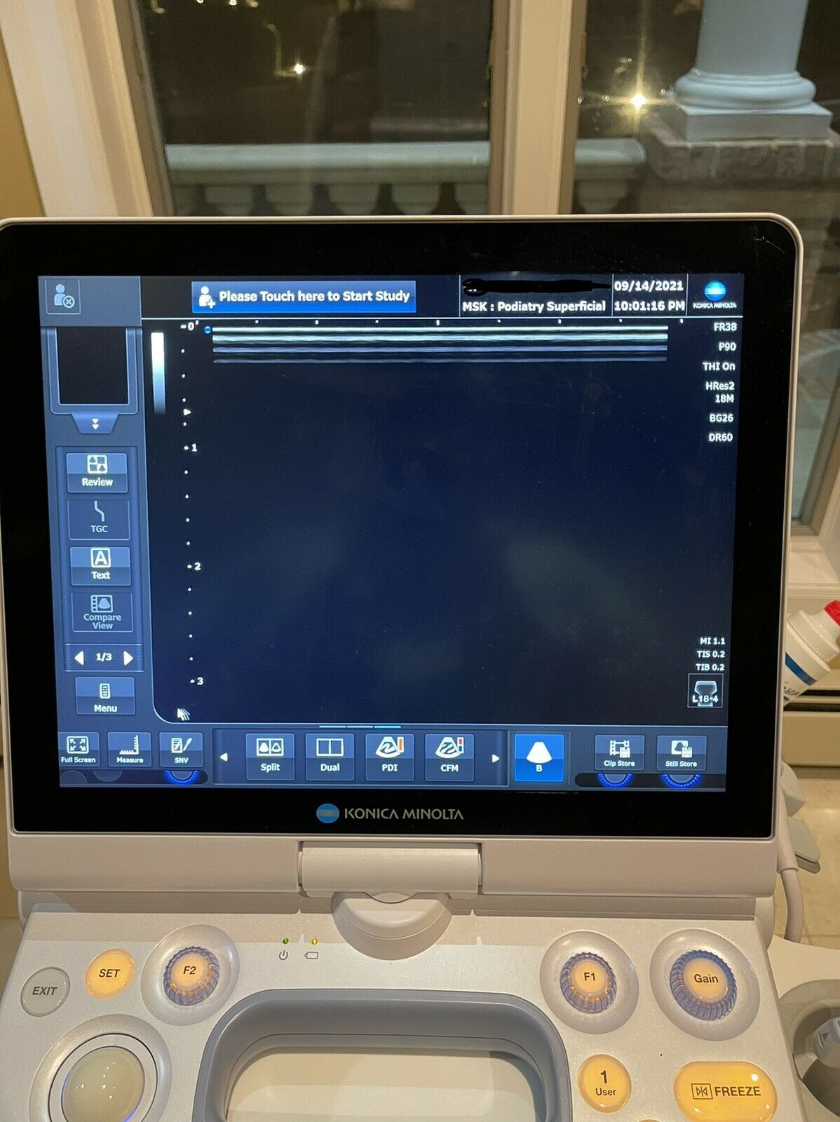 KONICA MINOLTA SONIMAGE HS1 PORTABLE ULTRASOUND MACHINE Full Warranty 2 Probes DIAGNOSTIC ULTRASOUND MACHINES FOR SALE