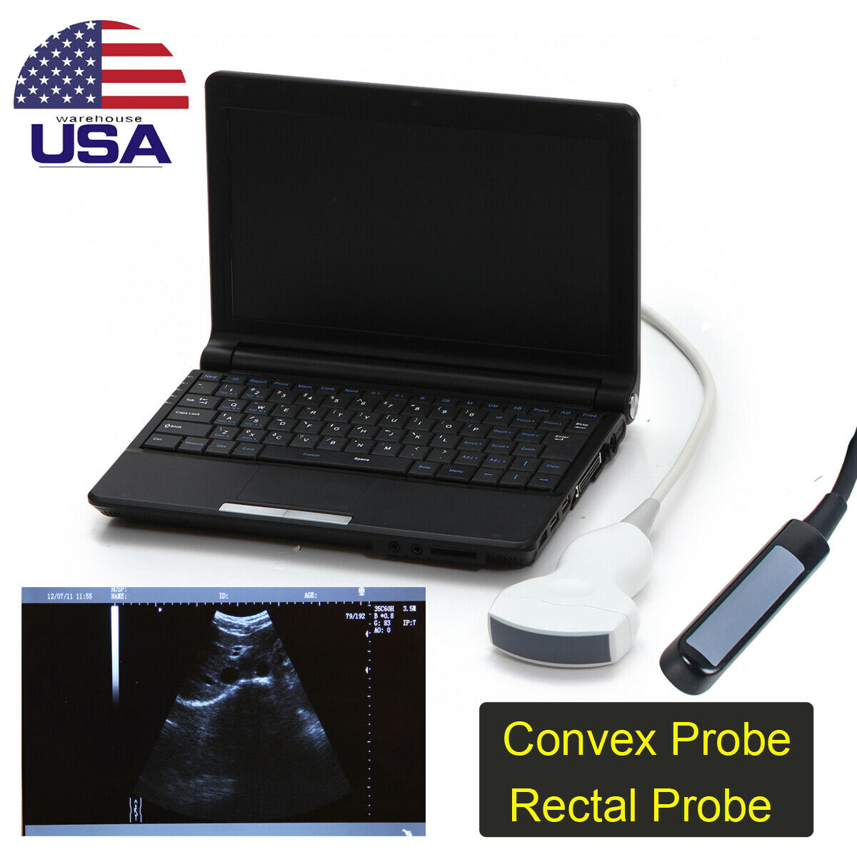 10" Full Digital Laptop Ultrasound Scanner Machine System + Convex Rectal Probe DIAGNOSTIC ULTRASOUND MACHINES FOR SALE