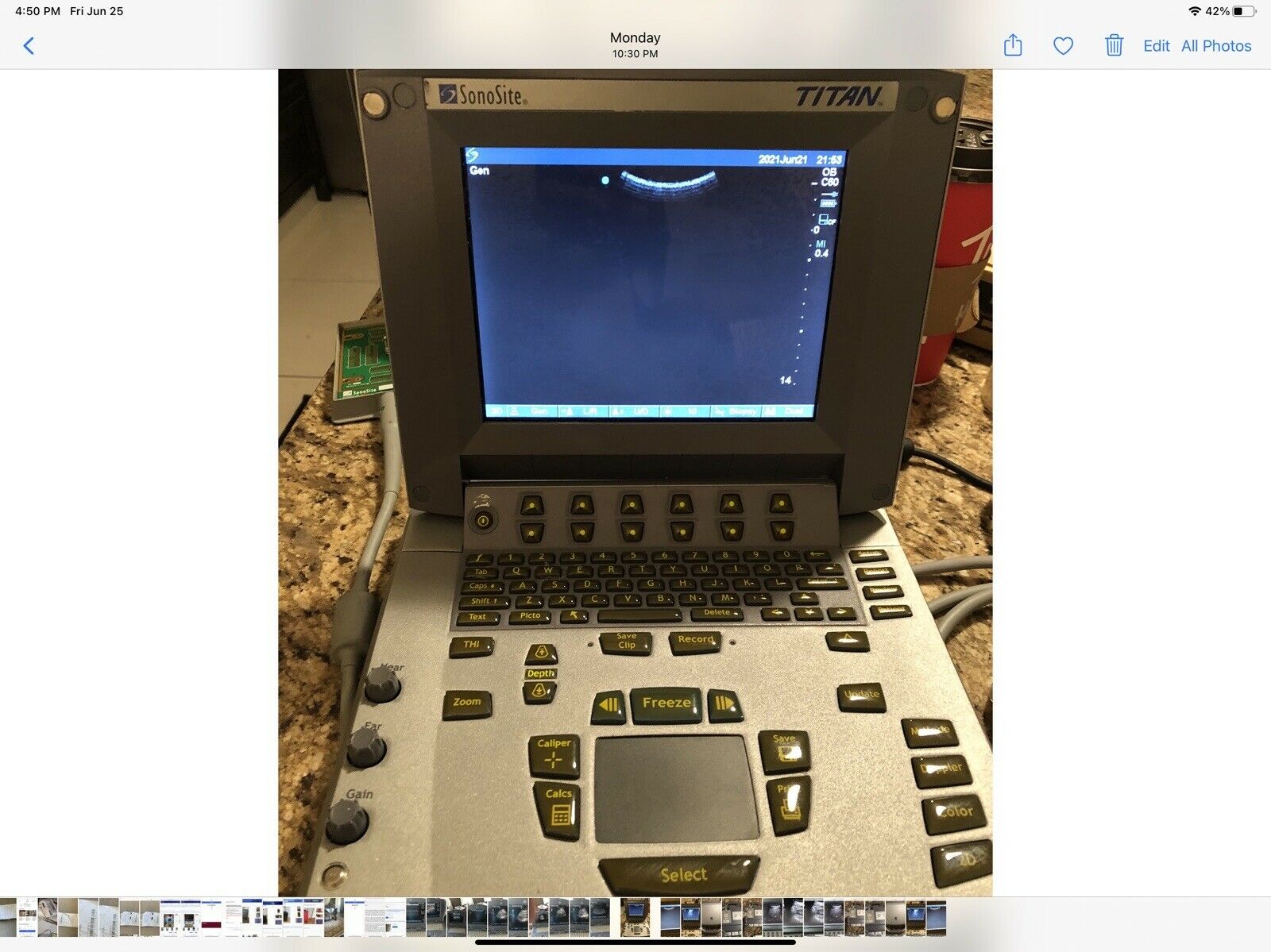 Sonosite Titan Portable Ultrasound Machine With Convex Probe C60/5-2mhz Probe DIAGNOSTIC ULTRASOUND MACHINES FOR SALE