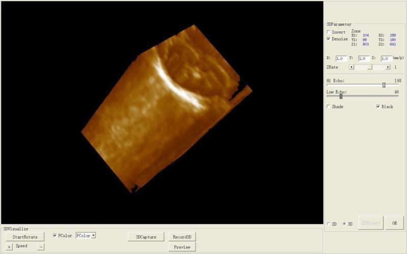 Ultrasound Unit Ultrasound Scanner/Machine Convex + Transvaginal 2 Probe 3D Sale DIAGNOSTIC ULTRASOUND MACHINES FOR SALE