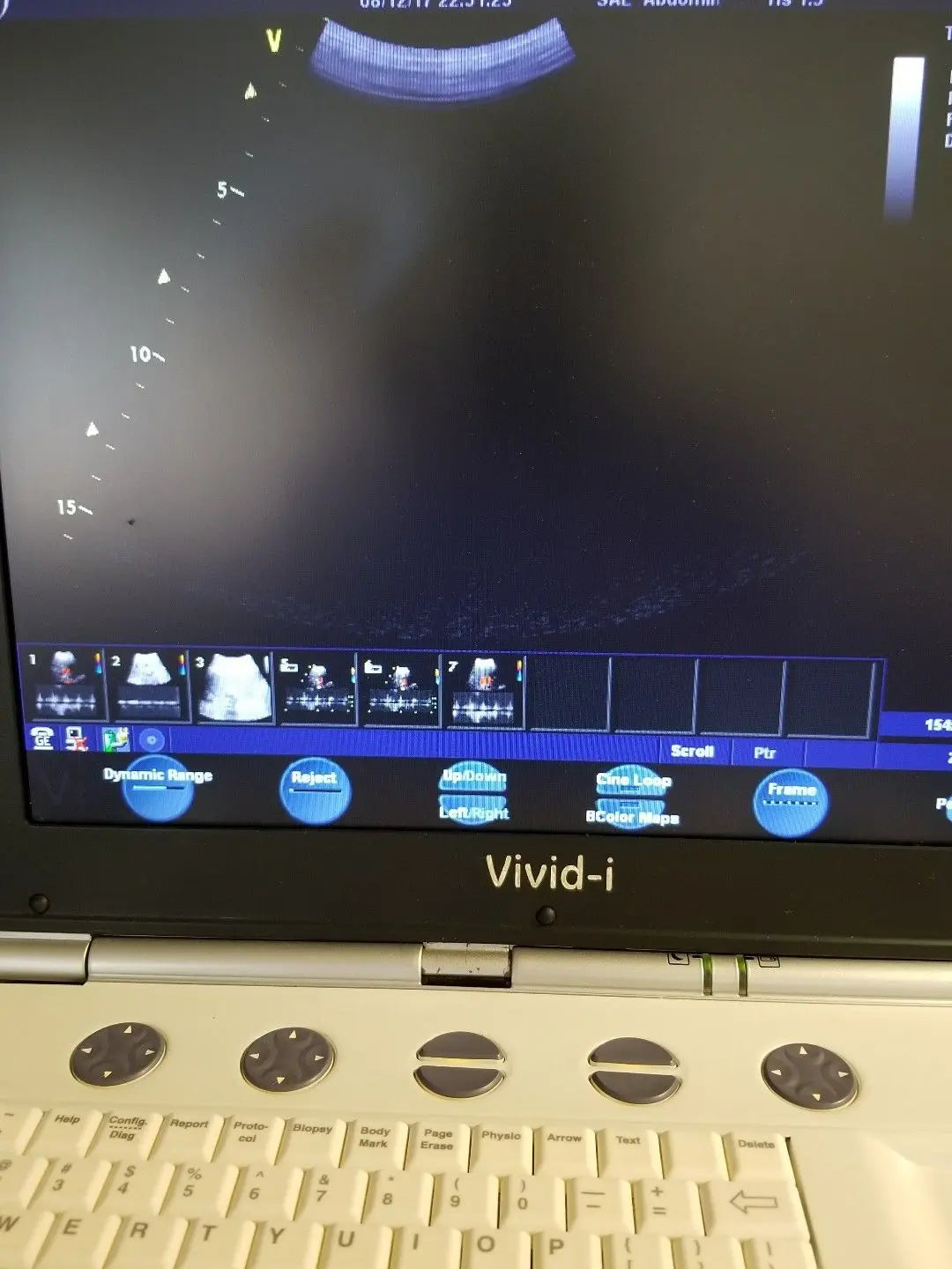 GE 4C-RS Ultrasound Probe / Transducer Refurbished DIAGNOSTIC ULTRASOUND MACHINES FOR SALE