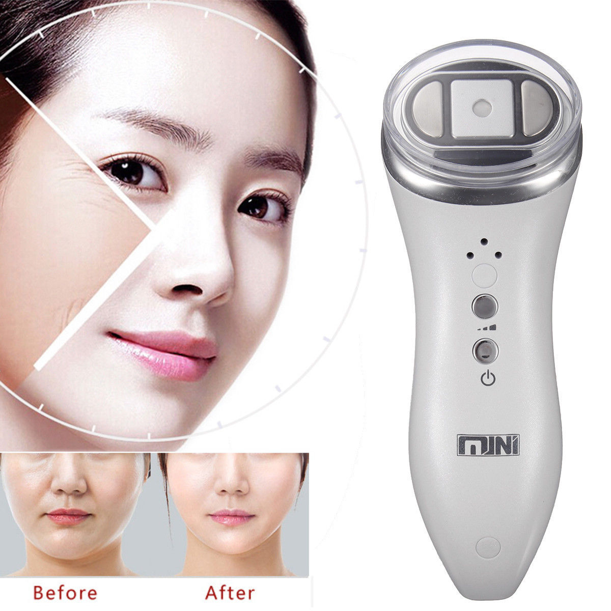 Mini HIFU High Intensity Focused Ultrasound Anti-Aging Wrinkle Removal