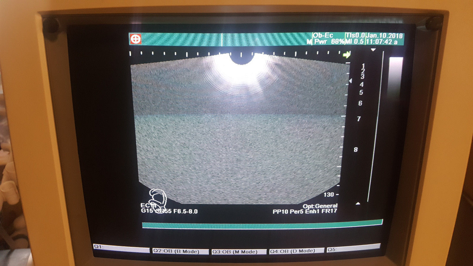 Shimadzu SDU-1200Pro Diagnostic Ultrasound unit 541-50049-03 OB, GYN, DIAGNOSTIC ULTRASOUND MACHINES FOR SALE