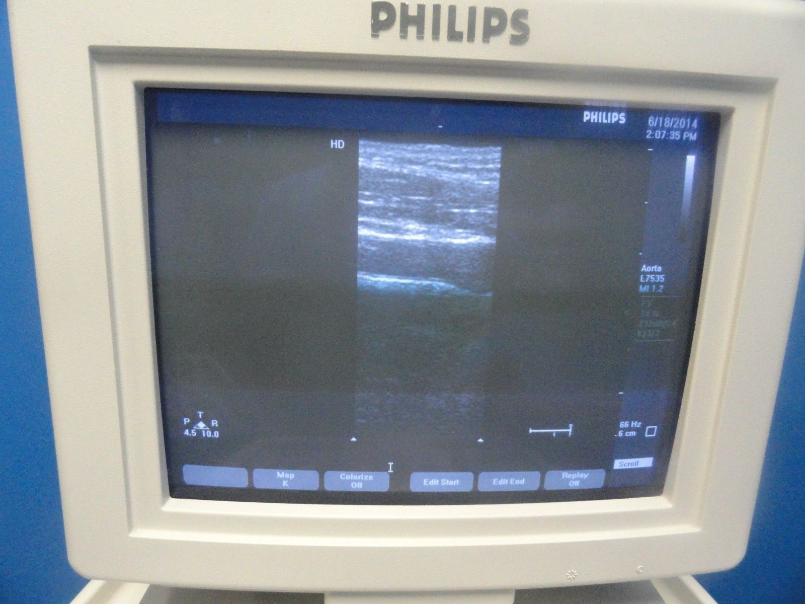 a monitor with a picture of a medical on it