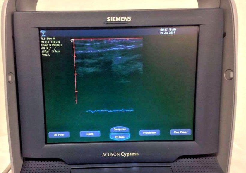 Siemens Acuson Plus Rev 20 Ultrasound Machine. BIOMED Certified & Warranty DIAGNOSTIC ULTRASOUND MACHINES FOR SALE