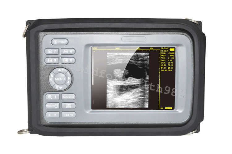 Color LCD Palmtop 5.5 Inch Ultrasound Scanner + Convex & Transvaginal 2 Probes DIAGNOSTIC ULTRASOUND MACHINES FOR SALE
