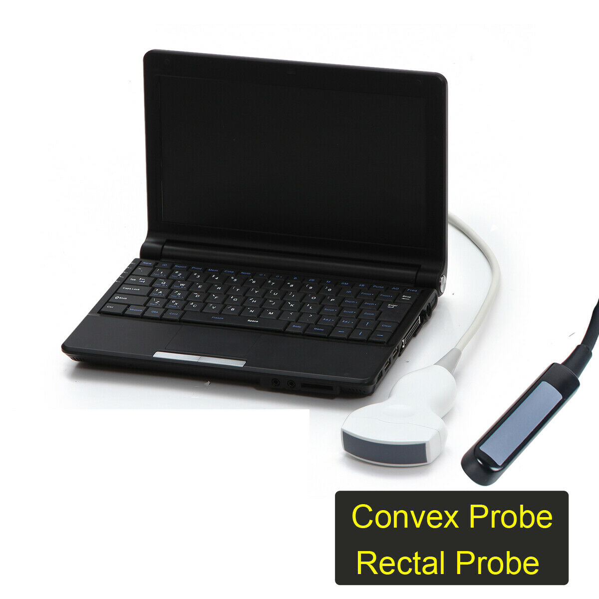 Portable Laptop Machine Digital Ultrasound Scanner 3.5MHz Probes 5.0MHz Probes DIAGNOSTIC ULTRASOUND MACHINES FOR SALE